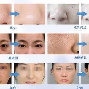 เครื่องดูแลผิวหน้าไฮโดร 2025 Korea Home 12 in 1 New Aqua H2o2 Jet Peel Peeling Solution พร้อมระบบอัจฉริยะ - Product Image 5
