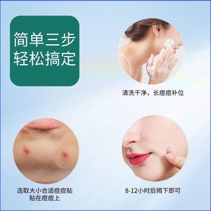 Master Acne Patches Transparent <b>Circle</b> Individual Pack Waterproof For All Skin Types Adults - Product Image 4