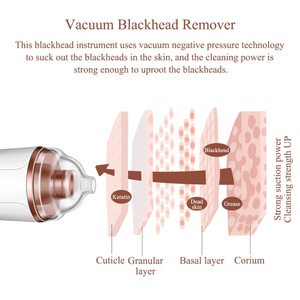 Extracteur Électrique de Points Noirs et d'Acné Pas Cher avec Kit d'Outils d'Aspiration Faciale – Appareil de Beauté pour l'Élimination des Points Noirs par Aspiration - Product Image 3