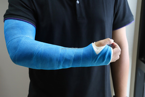 CE ISO Approved Clinic Hersteller Einfach zu bedienender Blue Fixation Fiberglas Synthetic Casting Bandage - Product Image 6