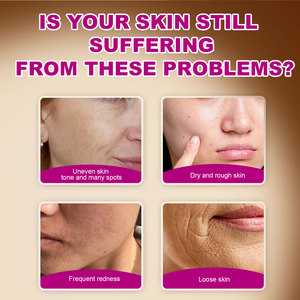 मजबूत सफेद चेहरा क्रीम अर्बुटिन 7% + ट्रांसमेरिक एसिड 4% मॉइस्चराइजिंग डार्क स्पॉट सुधार वाला सबसे अच्छा चेहरा लोशन - Product Image 3