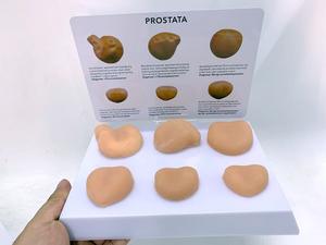 Modelo Anatómico de Tumor Prostático Humano para Ciencias Médicas, Modelo de Anatomía Humana - Product Image 6
