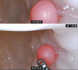 Modelo de Decúbito Lateral Gastrointestinal de Alta Calidad para Entrenamiento en Cirugía Gastroscópica, Modelo de Endoscopia - Product Image 5