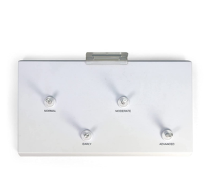 Modèle d'articulation du genou en science médicale, ensemble d'arthrose à 4 étapes, articulation du genou pour le bureau des médecins, outil éducatif - Product Image 6