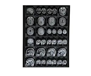 X-ray medis Film CT Scan termal 14X17 inci x Ray Film medis untuk Agfa Drystar 5302