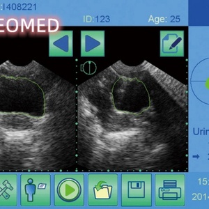 Échographe portable de poche BS01 de haute qualité pour le diagnostic du volume de la vessie - Product Image 5
