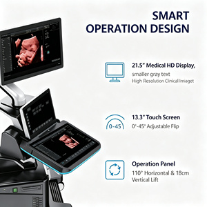 Sistema de Ultrasonido Doppler Color en Carro Médico para Diagnóstico Clínico en Hospitales, para Obstetricia/Ginecología y Cardiología - Product Image 2