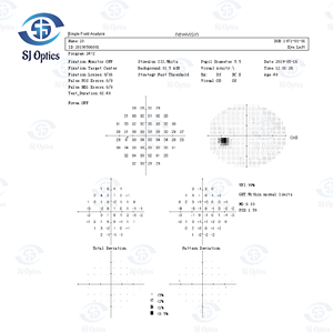 Analizador de Campo Visual Automatizado Optics Shanghai CE BIO-1000, Perímetro Estático con Equipo para Examen Ocular, 1 Año de Garantía, Metálico BIO-10 - Product Image 5
