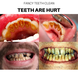 Customized Fruit Flavor 50mML Vegan Fluoride Free Stain Remover <strong>Colour</strong> <strong>Corrector</strong> Teeth Whitening Foam <strong>Toothpaste</strong> - Product Image 5