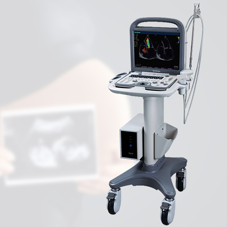 Ecografía ecógrafo 4D portátil Sonoscape S8 B/ 2B/ 4B/ M/CW Doppler Color