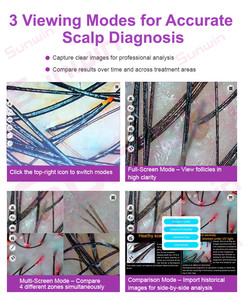 Đa Chức Năng Phân Tích Da Đầu Hệ Thống Chăm Sóc 5 Trong 1 Da Đầu Và Tóc Điều Trị Tóc Máy Phân Tích Với LED Massage Lược Súng Phun - Product Image 3