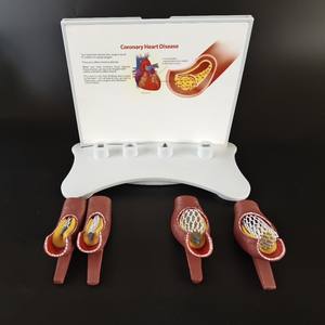 Учебные материалы по медицинским наукам: Стенты для лечения сердечно-сосудистых и цереброваскулярных заболеваний, атеросклероза - Product Image 2