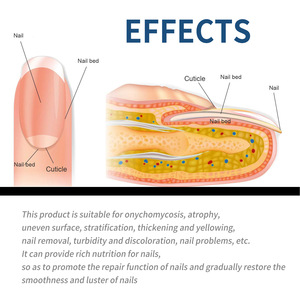 แผ่นแปะเท้าดีท็อกซ์ สำหรับเล็บขบ ผลิตจากสมุนไพร เป็นมิตรกับสิ่งแวดล้อม กันน้ำ บำรุง รักษาเล็บขบ 32 ชิ้น - Product Image 5