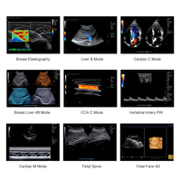 Instrument médical à ultrasons pour animaux, prix de la machine à ultrasons pour vétérinaire, scanner de grossesse à ultrasons