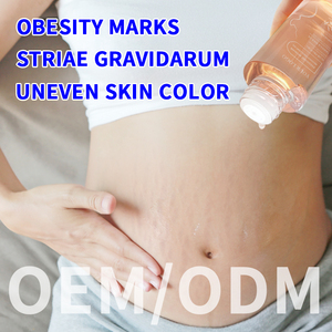 Guocui น้ำมันหอมระเหยสำหรับหญิงตั้งครรภ์ครีมลบรอยแผลเป็นหลังคลอดสำหรับป้องกันการตั้งครรภ์ - Product Image 2