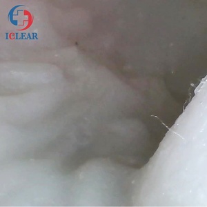 Modèle d'examen et de formation <span class=keywords><strong>ERCP</strong></span> de haute Simulation - Product Image 6