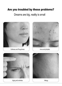 Máquina Portátil de Microdermoabrasión con Cristales, Exfolia e Ilumina la Piel, Máquina Facial de Peeling con Polvo de Cristal - Product Image 4