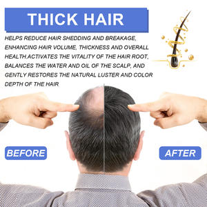 OUHOE Haute qualité Nettoyage en profondeur Réparation <span class=keywords><strong>Racine</strong></span> des <span class=keywords><strong>cheveux</strong></span> Follicule pileux Soin hydratant <span class=keywords><strong>Mousse</strong></span> pour <span class=keywords><strong>cheveux</strong></span> pour hommes 60ml - Product Image 5