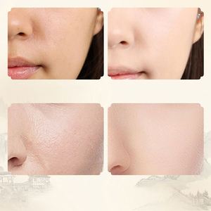 น้ำตบอัสตราการาลัส BAIZTON ราคาขายส่ง ช่วยเติมความชุ่มชื้น ปรับผิวกระจ่างใส ลดเลือนริ้วรอย บำรุงผิวหน้า - Product Image 2