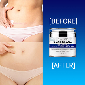 Crème <span class=keywords><strong>pour</strong></span> cicatrices faciales bio <span class=keywords><strong>pour</strong></span> le ventre et <span class=keywords><strong>les</strong></span> jambes Crème anti-<span class=keywords><strong>boutons</strong></span> et anti-vergetures Crème forte et efficace <span class=keywords><strong>pour</strong></span> enlever <span class=keywords><strong>les</strong></span> cicatrices d'acné - Product Image 3