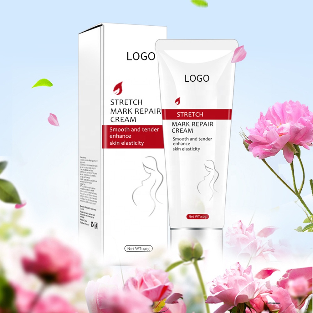 Natural Organic Stretch Marks Removal Cream Scars Repair Organic Herbal Stretch Mark Cream