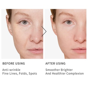 Suero Facial en Cápsulas con Logotipo Personalizado OEM, Suero Antiarrugas Reafirmante con Vitamina C - Product Image 6