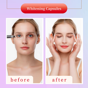 सर्वश्रेष्ठ ग्लुटा चमक एल-ग्लूटाथियोन कम कैप्सूल सुपर व्हाइटनिंग त्वचा कैप्सूल ग्लैथनी कैप्सूल - Product Image 5