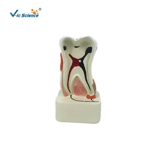 Diş patolojisi Model diş modeli diş uygulaması
