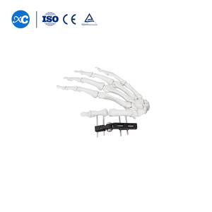 Profesional Of-<span class=keywords><strong>Distal</strong></span> <span class=keywords><strong>Radius</strong></span> Fixator B pergelangan tangan sendi ortopedi tulang eksternal Fixator - Product Image 5