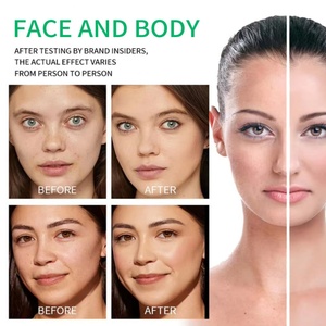 Suero Blanqueador e Iluminador Profesional para el Cuidado Facial y Corporal, Extracto de Papaya, Cuidado Profesional de la Piel - Product Image 3
