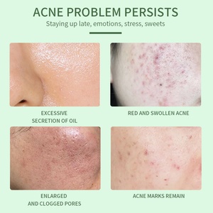 Sérum liquide anti-acné à l'acide salicylique 30 ml en gros – Formule de soin cutané pour resserrer les pores et réparer les muscles - Product Image 2