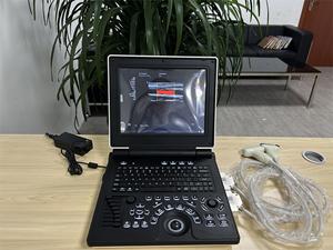 Mesin Doppler <span class=keywords><strong>Ultrasound</strong></span> elektrik hitam 12 inci, peralatan diagnostik dokter hewan, peralatan perangkat medis logam - Product Image 3