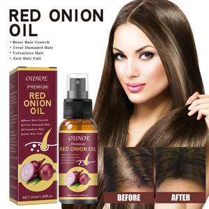 Custom Logo Natural Formula Scalp Nourishing <strong>Hair</strong> Growth Serum Red <strong>Onion</strong> <strong>Oil</strong> - Product Image 1