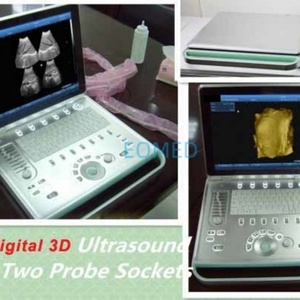 Escáner de Ultrasonido Multipropósito para Uso Humano y Veterinario con Modo Doppler PW, Máquina de Ultrasonido Obstétrico Portátil BW09 - Product Image 4