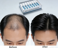 Traitement naturel anti-chute de cheveux, sérum de croissance des cheveux, huile de croissance des cheveux, sérum coréen de réparation et de renouvellement GHK-Cu, ampoule de croissance des cheveux