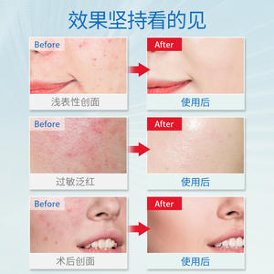 Patch réparateur au hyaluronate de sodium Teiener Medical, 5 pièces, soin du visage après traitement, compresse rafraîchissante - Product Image 4