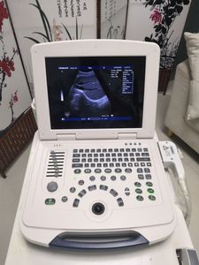 מכשיר אבחון אלחוטי כפול ראש מכשיר אבחון אלחוטי, מכשיר אבחון אולטרסאונד צבע נייד עבור בתי חולים - Product Image 3