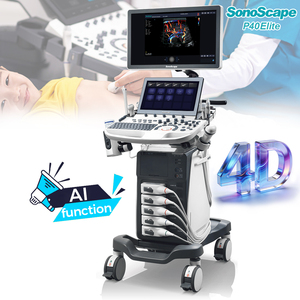 Diagnóstico asistido por IA Sonoscape P40 Elite Digital Color Doppler Ultrasonido Máquina 3D 4D Máquina De Ultrasonido para cardiología - Product Image 1
