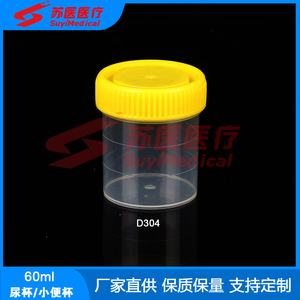 ถ้วยเก็บปัสสาวะ SuyiMedical ขนาด 60 มล. ฝาเกลียว ภาชนะพลาสติกสำหรับเก็บตัวอย่างทางการแพทย์ รุ่น D303 D304 - Product Image 3