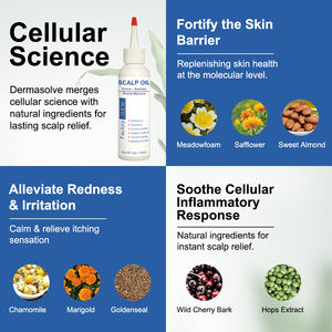 Huile de <span class=keywords><strong>psoriasis</strong></span> et de pellicules de marque privée pour le cuir chevelu huile de massage apaisante squameuse anti-démangeaisons pour le cuir chevelu - Product Image 4