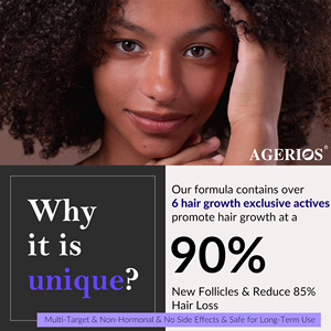 سيروم نمو الشعر بتركيبة 30 مل مع 3% ريدينسيل و2% أناجين، يمنع DHT ويمنح الشعر مظهرًا أكثر كثافة وامتلاءً. - Product Image 4