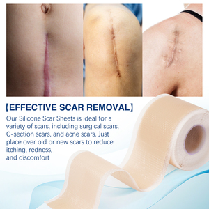Elaimei Prêt à Expédier Bandes de Gel de Silicone pour Réparation de Cicatrices, Feuilles de Silicone pour Cicatrices, Rubans Adhésifs pour Éliminer les Vergetures et Grandes Cicatrices de Césarienne - Product Image 5