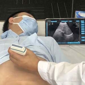 Sonde sans fil à ultrasons <span class=keywords><strong>portable</strong></span> Doppler Wifi/Sonde à ultrasons sans fil HD linéaire convexe - Product Image 3