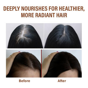 น้ำมันปลูก<span class=keywords><strong>ผม</strong></span>สมุนไพรพร้อมสารสกัดจากหลายก้อนสารสกัดป้อ<span class=keywords><strong>ง</strong></span>กันการหลุดร่วงขอ<span class=keywords><strong>ง</strong></span>เส้น<span class=keywords><strong>ผม</strong></span>รั<span class=keywords><strong>ง</strong></span>แคสำหรับการรักษา<span class=keywords><strong>ผม</strong></span><span class=keywords><strong>เสีย</strong></span> - Product Image 5