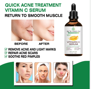 <span class=keywords><strong>ROUSHUN</strong></span> วิตามินซีเซรั่ม เซรั่มบํารุงผิวหน้า - Product Image 2