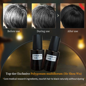 Alta calidad <span class=keywords><strong>Natural</strong></span> Polygonum Multiflorum Fo-ti Anti Grey Hair Prevention Care White Hair to Black <span class=keywords><strong>Tratamiento</strong></span> Suero permanente - Product Image 4