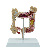 Modelo de Simulación Médica DARHMMY del Colon y Intestino Grueso Humano
