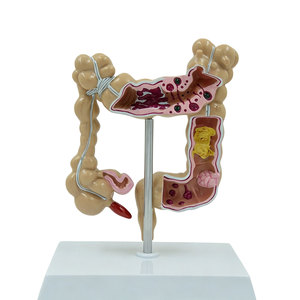 Modello di Simulazione Medica DARHMMY del Colon e dell'Intestino Grande Umano - Product Image 1