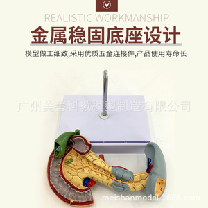 Modèle de simulation pédagogique des tissus pathologiques du pancréas, de la rate, du foie, de la vésicule biliaire et du duodénum ; spécimen pathologique du pancréas - Product Image 2