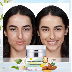 <span class=keywords><strong>Crème</strong></span> Visage Personnalisée au Logo, à l'Extrait Végétal de Niacinamide, Éclaircissante Anti-Taches, Soin du Visage à la Vitamine E et à l'Huile de Jojoba, pour Tous Types de Peau - Product Image 6